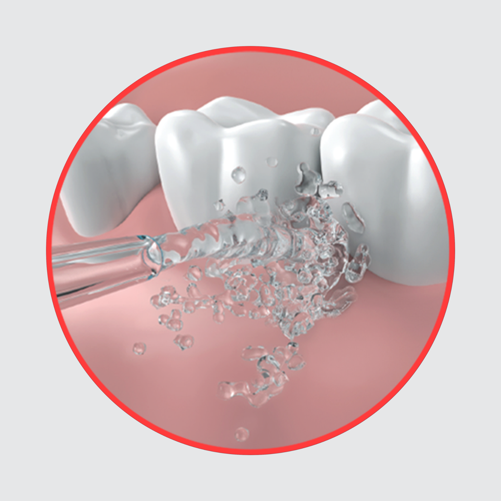 Dentagenie Water Flosser
