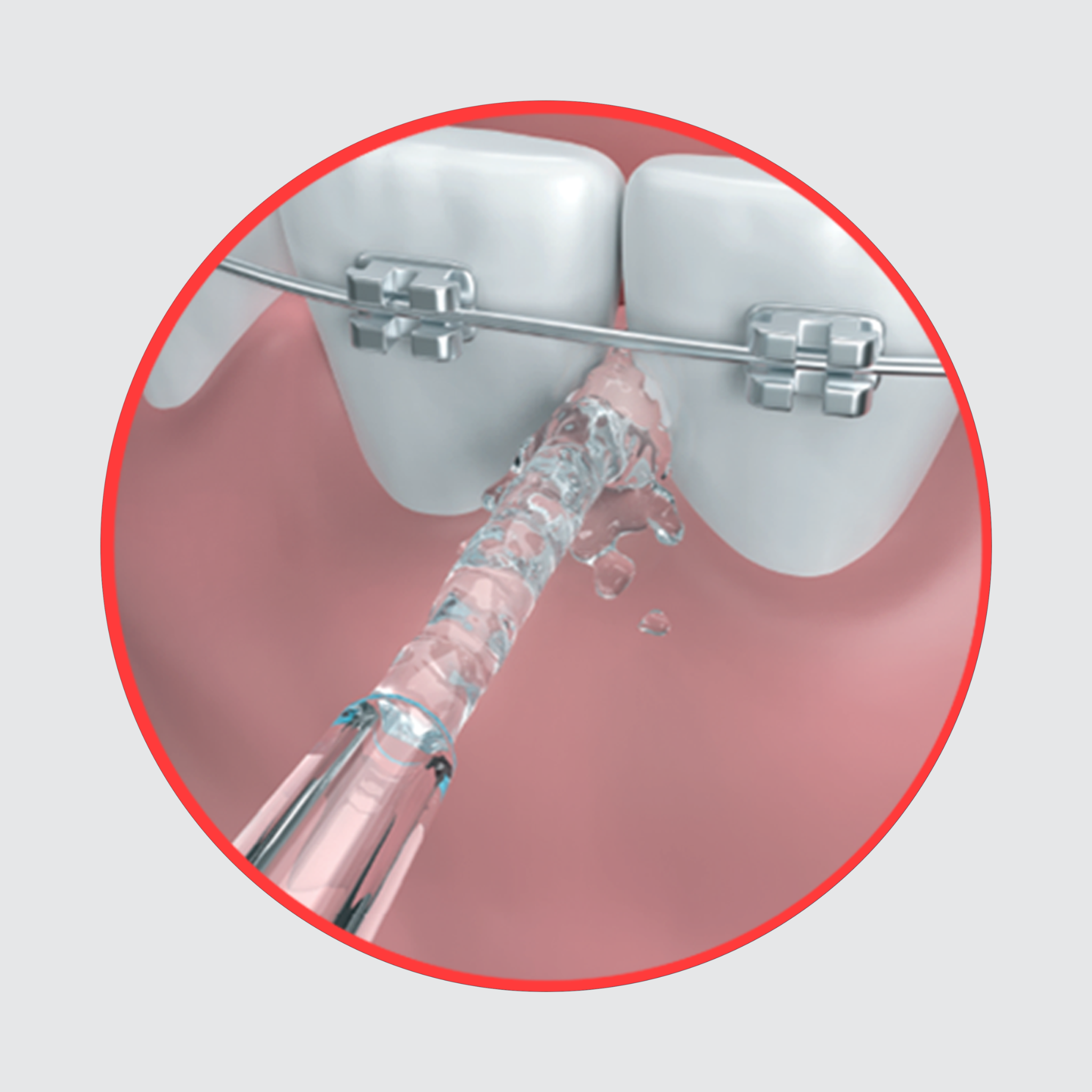 Dentagenie Water Flosser