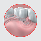 Dentagenie Water Flosser