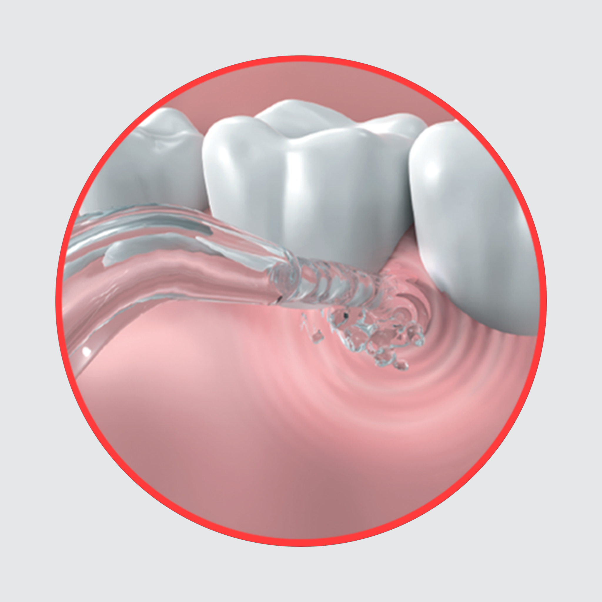 Dentagenie Water Flosser