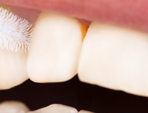 Efficacy of a rubber bristles interdental cleaner compared to an interdental brush