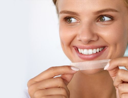 Clinical trials on the use of whitening strips in children and adolescents